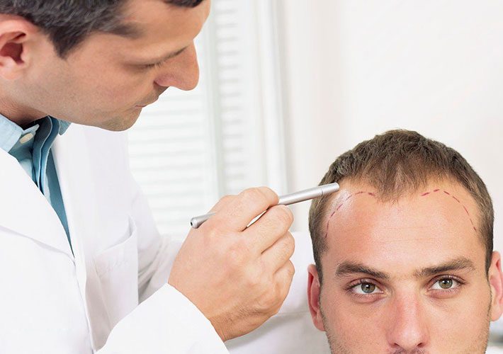 درمان قطعی ریزش موی سکه ای