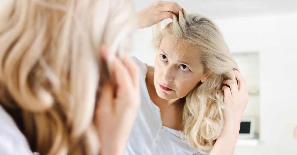 درمان ریزش موی یائسگی